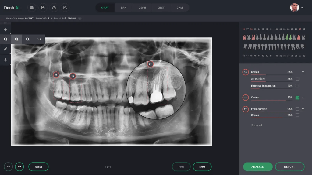 dashboard of Denti ai