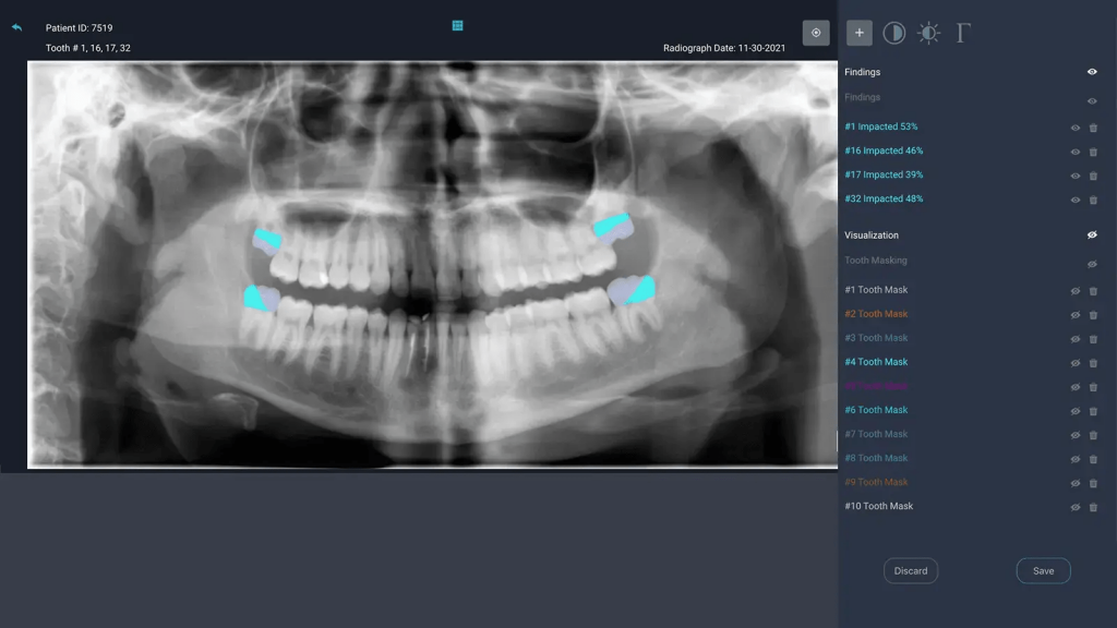 dashboard of Overjet ai
